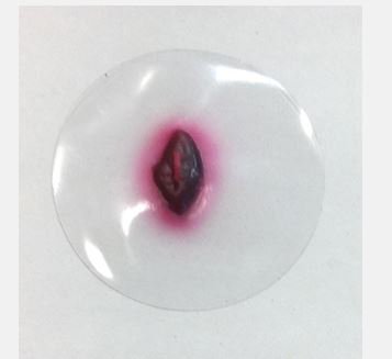 Picture of Small Exit Wound800-733