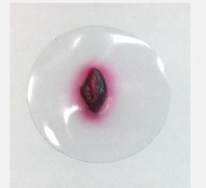 Picture of Small Exit Wound800-733