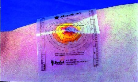 Picture of Measuring Guide 3-3/4 X 5-1/2 Inch PlasticB250