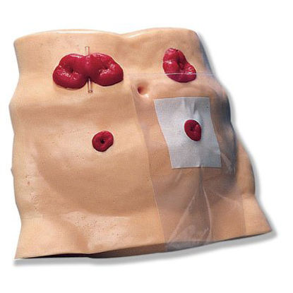 Picture of Ostomy Care Model Synthetic TissueSB23501