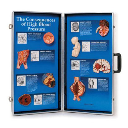 Picture of Contraceptives GuideZ02810