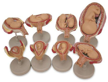 Picture of Fetus Development Set NascoSB47759