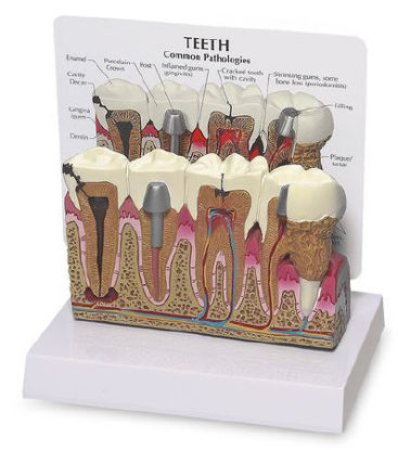 Picture of Teeth NascoSB35432