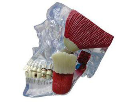 Picture of Temporomandibular Joint Model GPI Anatomicals810983