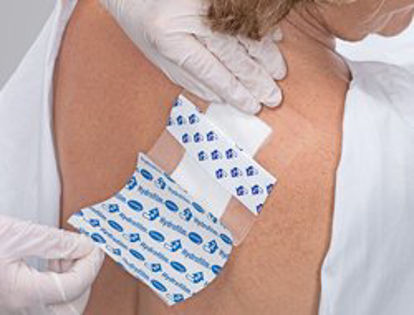 Picture of Transparent Film Dressing Hydrofilm® Rectangle 6 X 8 Inch 4 Tab Delivery Without Label Sterile685761