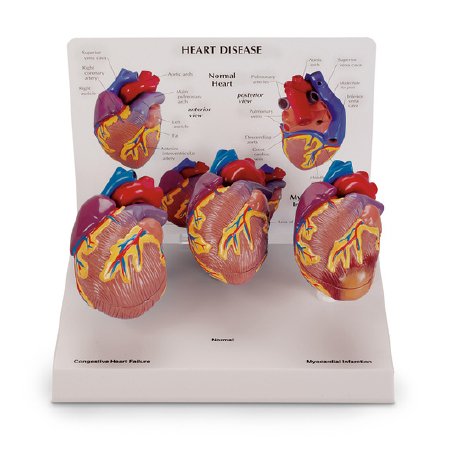 Picture of Heart Models NascoSB44893