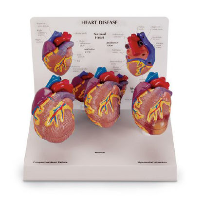 Picture of Heart Models NascoSB44893