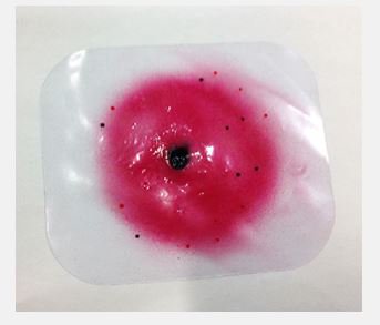 Picture of Intermediate Range Wound800-720