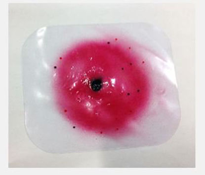 Picture of Intermediate Range Wound800-720