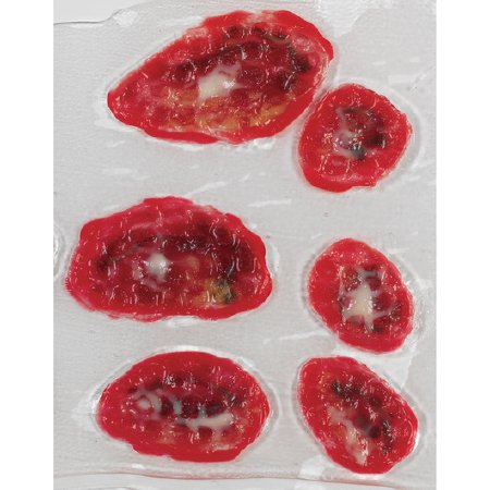 Picture of Wound Makeup Life/Form® Venous Stasis UlcerLF00792