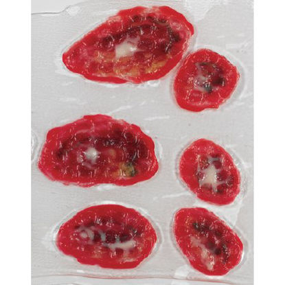 Picture of Wound Makeup Life/Form® Venous Stasis UlcerLF00792