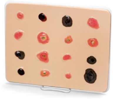 Picture of Skin Cancer Trainer Life/Form®LF00950