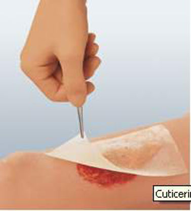 Picture of Impregnated Dressing Cuticerin 3 X 8 Inch Gauze Cuticerin Ointment Sterile66045561