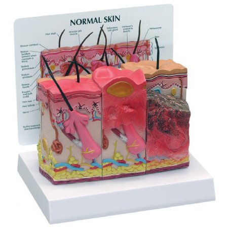 Picture of Skin Burn Normal Model NascoSB46482