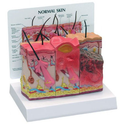 Picture of Skin Burn Normal Model NascoSB46482