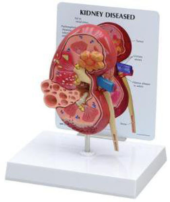Picture of Kidney Model GPI Anatomicals810975