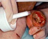 Picture of Hydrogel Dressing Intrasite 8 gm66027308