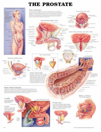 Picture of Anatomical Chart Prostate 20 X 26 Inch Plastic Wall Mount Laminated9781587791895