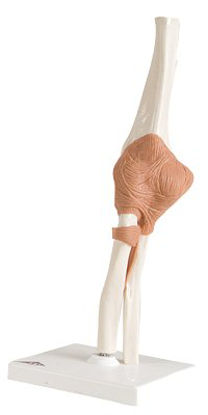 Picture of Functional Elbow Joint Model 13 lbs.12-4512