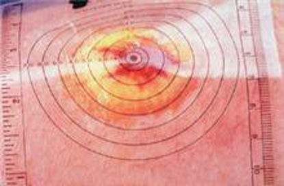 Picture of Wound Measuring Guide 5.25 X 3.25 Inch Plastic70831