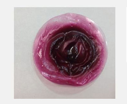 Picture of Protrusion Stikon800-901