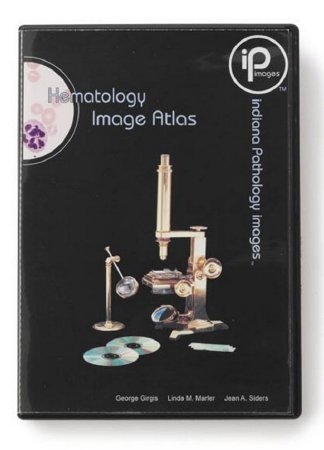 Picture of Haematology Image1685