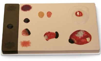 Picture of Pressure Ulcer Model ‘Pat’ Pressure Ulcer Model™ 5-1/2 lbs.SB46506