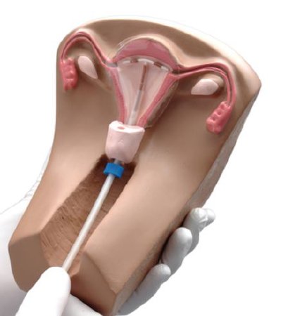 Picture of Female Pelvic Organs Model Gaumard®SB40534