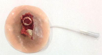 Picture of Moulage Xtreme Open Fracture Clavicle Plastic800-013