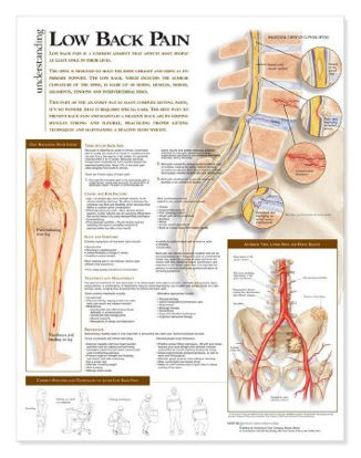 Picture of Anatomical Chart Low Back Pain 20 X 26 Inch Heavy Paper Grommets Laminated9780781782425