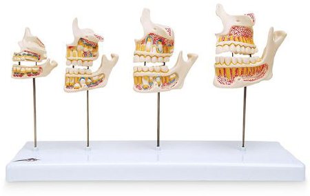 Picture of Dentition Development NascoSB41406