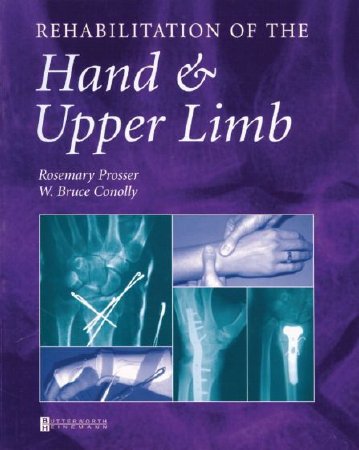 Picture of Reference Book Rehabilitation of the Hand and Upper Limb Rosemary Prosser, BApSc (Physio), MSc, CHT and W. Bruce Conolly, AM, FRACS, FRCS, FACS554575