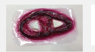 Picture of Femur Stick-On800-908