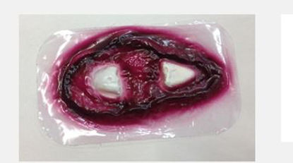 Picture of Femur Stick-On800-908