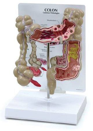 Picture of Colon Model NascoSB35434