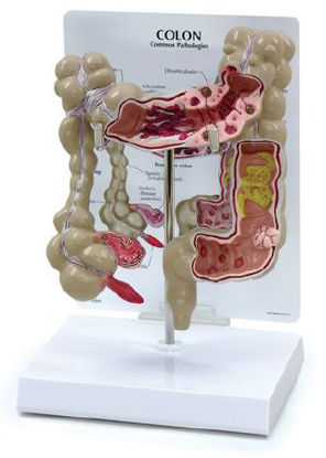 Picture of Colon Model NascoSB35434