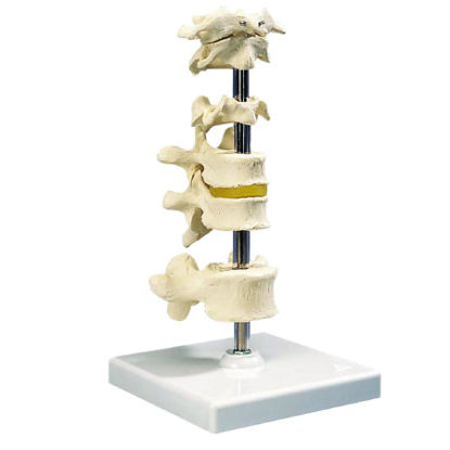 Picture of 6 Mounted Vertebrae Model 4 lbs.12-4593