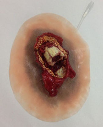 Picture of Moulage Xtreme Open Fracture Femur Plastic800-012