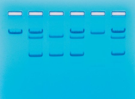 Picture of Student Lab Activity Edvotek™ Sickle Cell Gene Detection (DNA-based)S96346