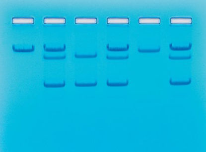 Picture of Student Lab Activity Edvotek™ Sickle Cell Gene Detection (DNA-based)S96346