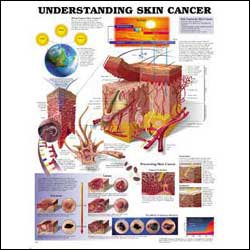 Picture of Anatomical Chart Understanding Skin Cancer 20 X 26 Inch Heavy Paper Laminated9781605470948