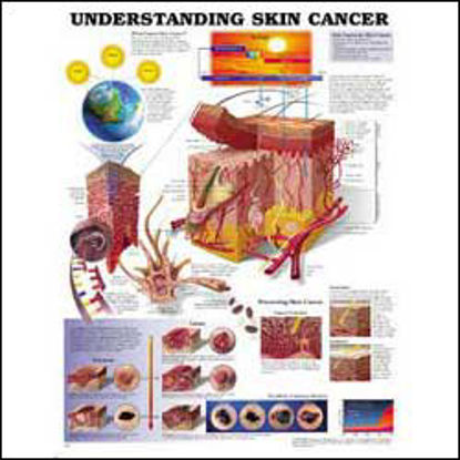 Picture of Anatomical Chart Understanding Skin Cancer 20 X 26 Inch Heavy Paper Laminated9781605470948