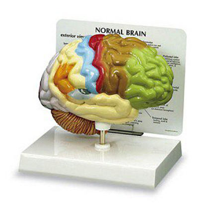 Picture of Half Brain Model NascoSB40235