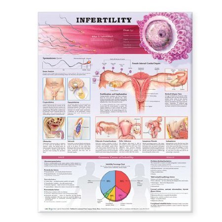 Picture of Anatomical Chart Infertility 19 X 26 Inch Plastic Wall Mount Laminated158779859X
