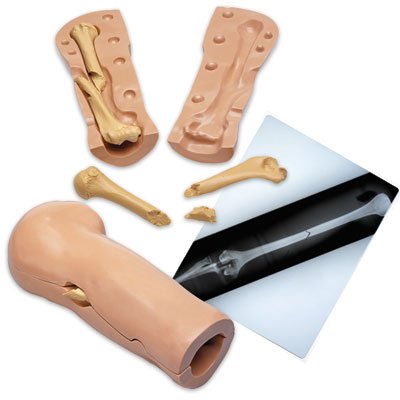 Picture of Imaging Fracture Simulator Life/Form®LF01210