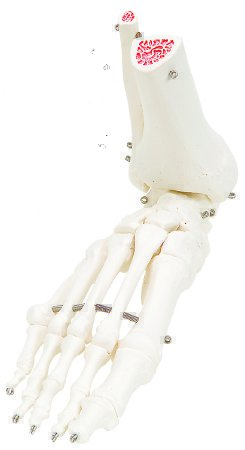 Picture of Loose Bones Right Leg Skeleton with Hip Bone 3 lbs. Plastic12-4587R