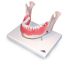 Picture of Dental Disease Teeth Model AdultSB41498