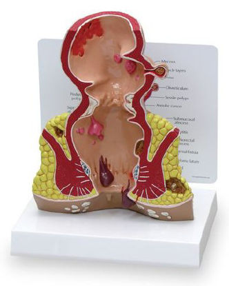 Picture of Rectum NascoSB35433