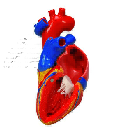 Picture of Heart with Bypass Model 1 lb.12-4568