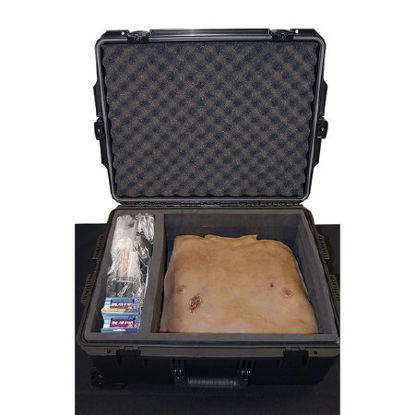 Picture of Needle Decompression Manikin Kit MST™ Gender NeutralSB50236